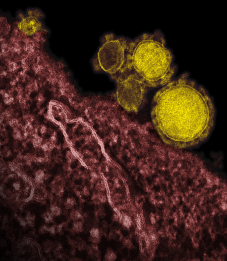 Middle East Respiratory Syndrome (MERS) Middle East Respiratory Syndrome (MERS)