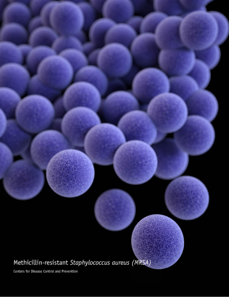 Staphylococcus aureus: Methicillin- Resistant Invasive Disease Staphylococcus aureus: Methicillin- Resistant Invasive Disease