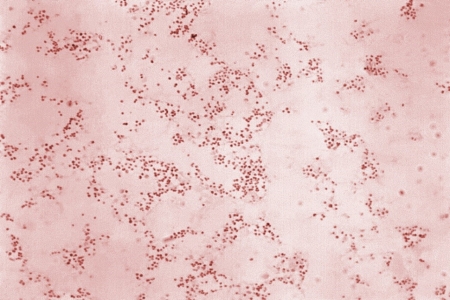 Tularemia (Francisella tularensis) Tularemia (Francisella tularensis)