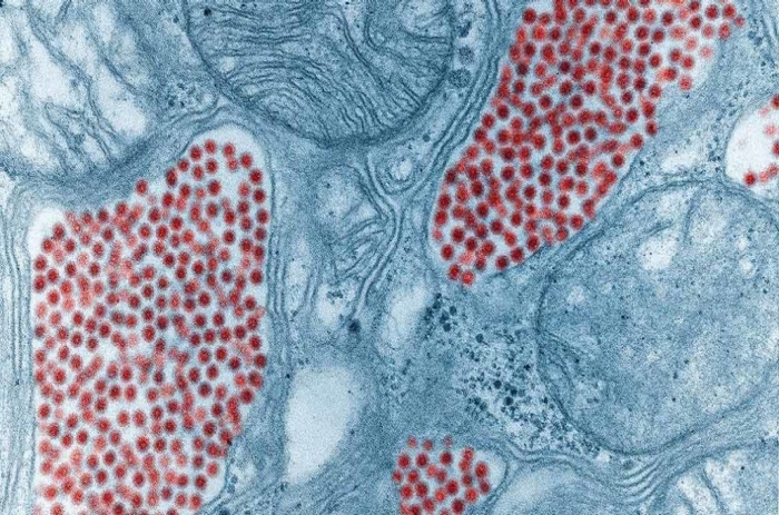 Eastern equine encephalitis virus Eastern equine encephalitis virus