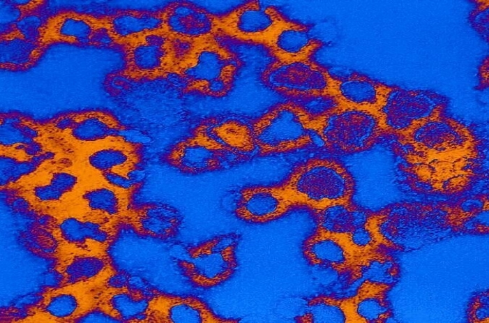 La Crosse virus La Crosse virus