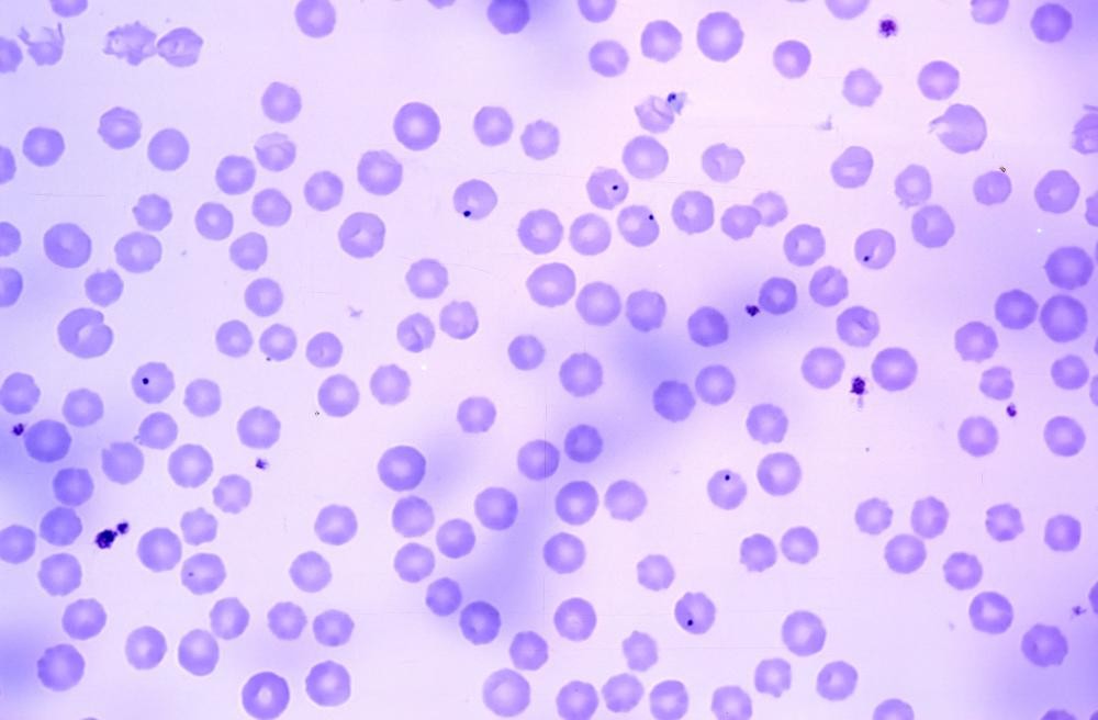 Anaplasmosis under a microscope