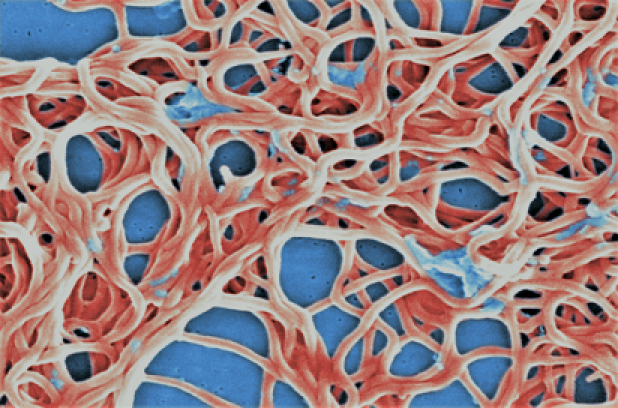 Lyme disease