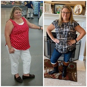 Deborah P. Before and After Deborah P. before and after